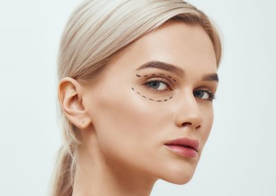 Chirurgie des paupières ou blepharoplastie